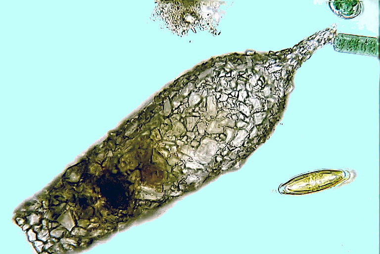 amoeba